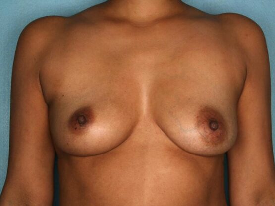 Case # 23 before photo