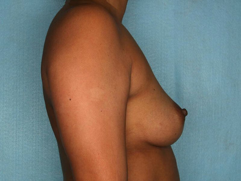 bna image