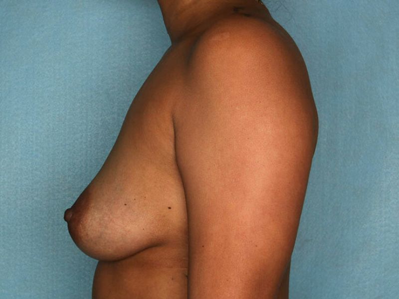 bna image