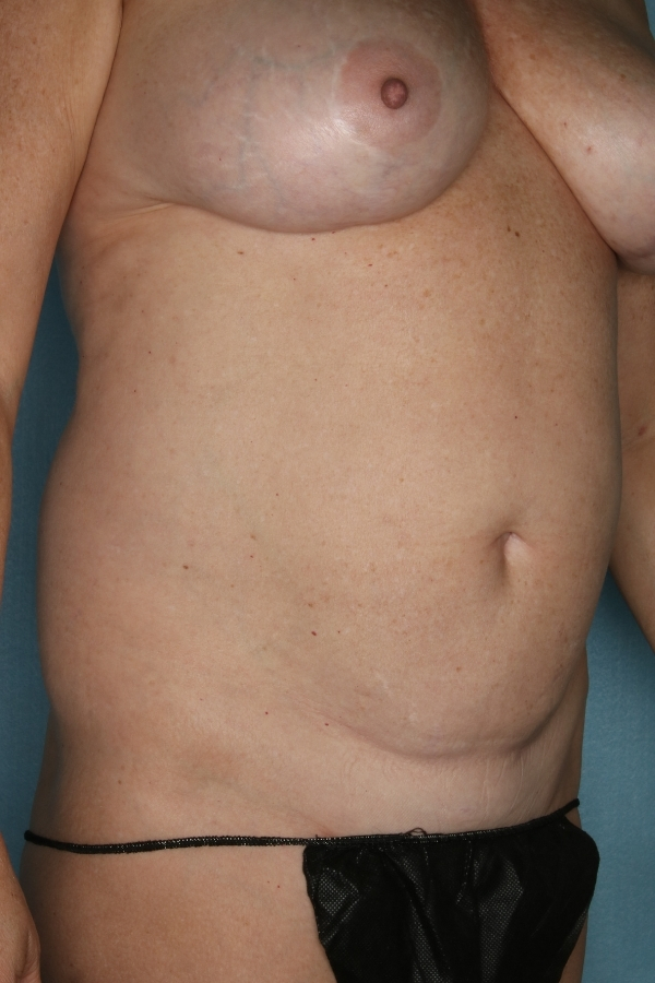  bna image