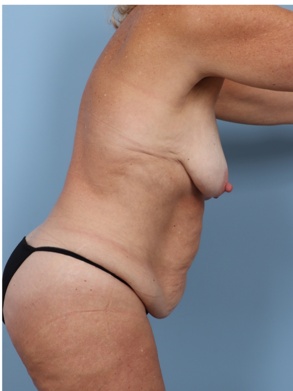  bna image