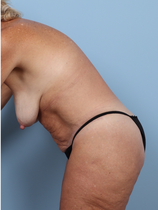 bna image