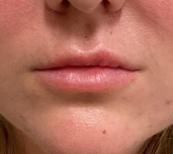 Case # 30 before photo