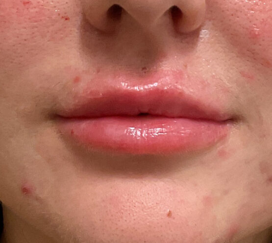 Case # 30 after photo